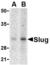 Western blot analysis of Slug in human kidney cell lysate with Slug antibody at in (A) 1 and (B) 2 μg/mL