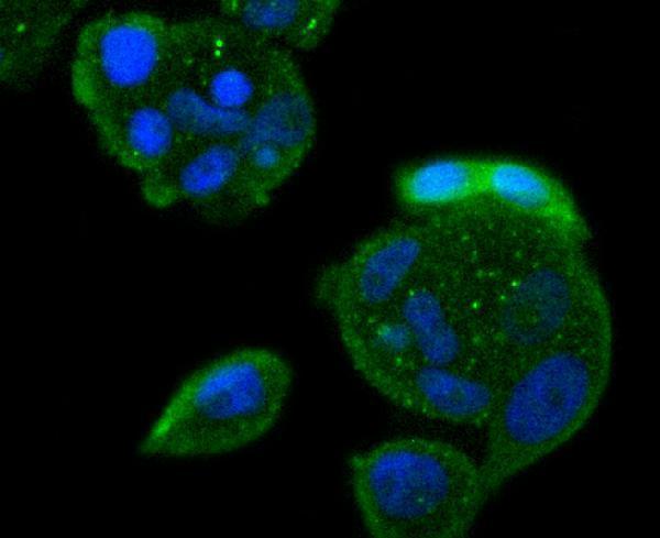 ICC staining Bcl10 in MCF-7 cells (green)
