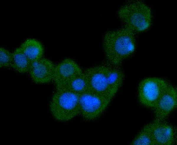 ICC staining Bcl10 in SW480 cells (green)