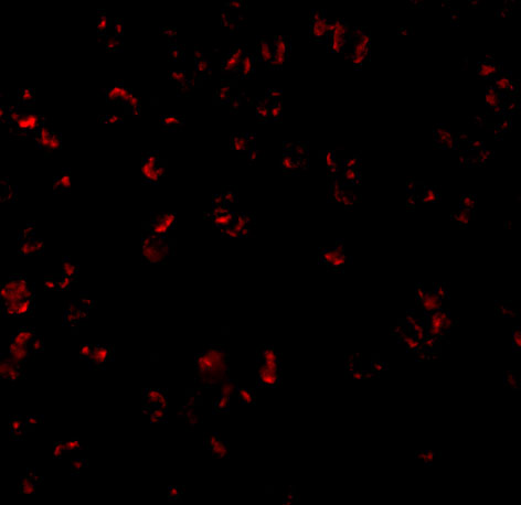 Immunofluorescence of Bcl-10 in Raji cells with Bcl-10 antibody at 10 μg/mL