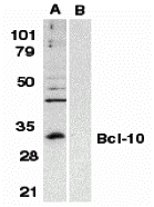 Western blot analysis of Bcl-10 in Raji whole cell lysate in the absence (A) or presence (B) of peptide (A01616P) with Bcl-10 antibody at 1:500 dilution