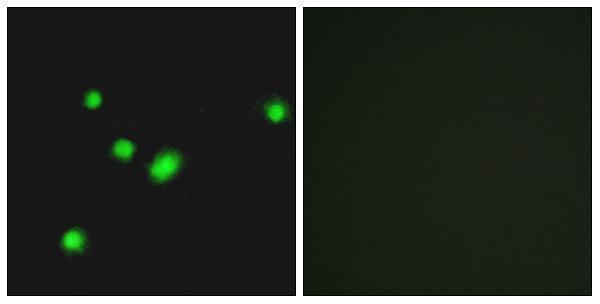 Immunofluorescence analysis of A549 cells, using MUTYH Antibody