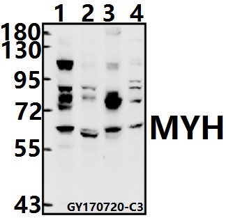 Western blot (WB) analysis of MYH (Y176) pAb at 1:500 dilution
Lane1:K562 whole cell lysate(40ug)
Lane2:U-87MG whole cell lysate(40ug)
Lane3:C6 whole cell lysate(40ug)
Lane4:AML-12 whole cell lysate(40ug)