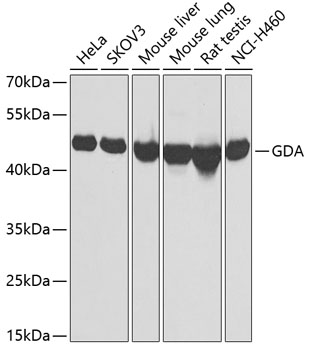 Western blot analysis of extracts of various cell lines, using GDA Antibody  at 1:1000 dilution