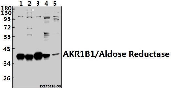 Western blot (WB) analysis of AKR1B1/Aldose Reductase (K275) pAb at 1:1000 dilution
Lane1:A549 whole cell lysate(10ug)
Lane2:HEK293T whole cell lysate(10ug)
Lane3:Hela whole cell lysate(10ug)
Lane4:The Embryo tissue lysate of Mouse(40ug)
Lane5:The Kidney tissue lysate of Rat(40ug)