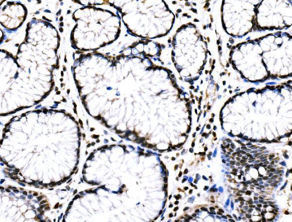  IHC analysis of RAD18 using anti-RAD18 antibody (A01622-2)