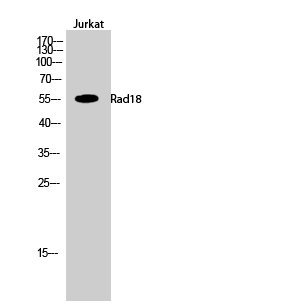 Western Blot (WB) analysis of Jurkat cells using Rad18 Polyclonal antibody