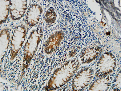 Immunohistochemical analysis of paraffin-embedded Human colon