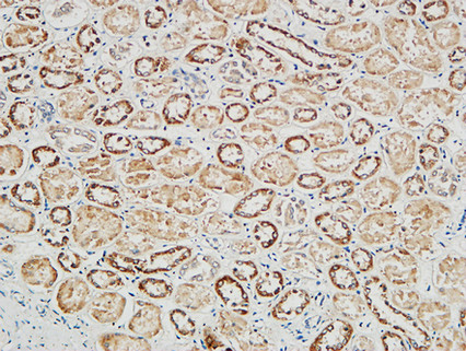 Immunohistochemical analysis of paraffin-embedded Human Right kidney