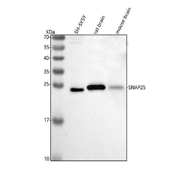  Western blot analysis of SNAP25 using anti-SNAP25 antibody (A01625-1)