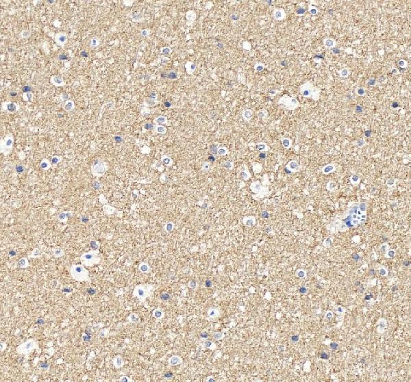 IHC analysis of SNAP25 using anti-SNAP25 antibody (A01625)