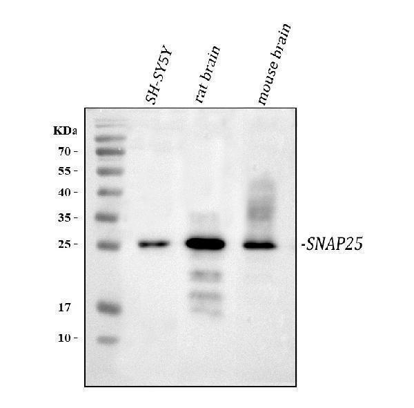  Western blot analysis of SNAP25 using anti-SNAP25 antibody (A01625)