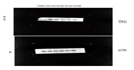  Western blot analysis of Tryptophan Hydroxylase using anti-Tryptophan Hydroxylase antibody (A01626-1)