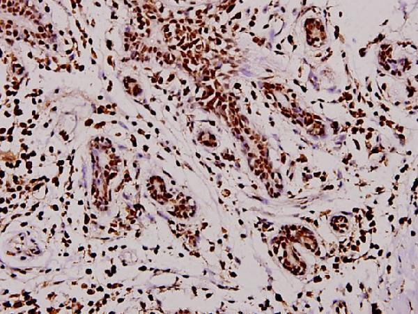 a01626 2 tph1 primary antiboties ihc testing 2