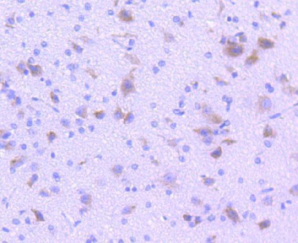 Immunohistochemical analysis of paraffin-embedded rat brain tissue using anti-TPH1 antibody