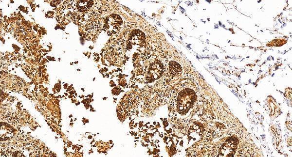IHC analysis of TPH1 using anti-TPH1 antibody (A01626-4)
