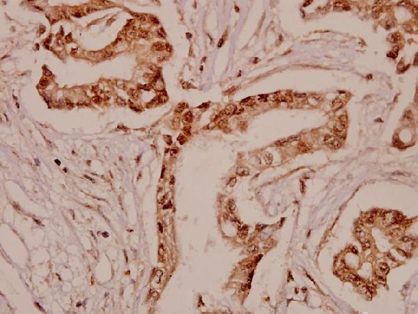 a01626 tph1 primary antiboties ihc testing 2