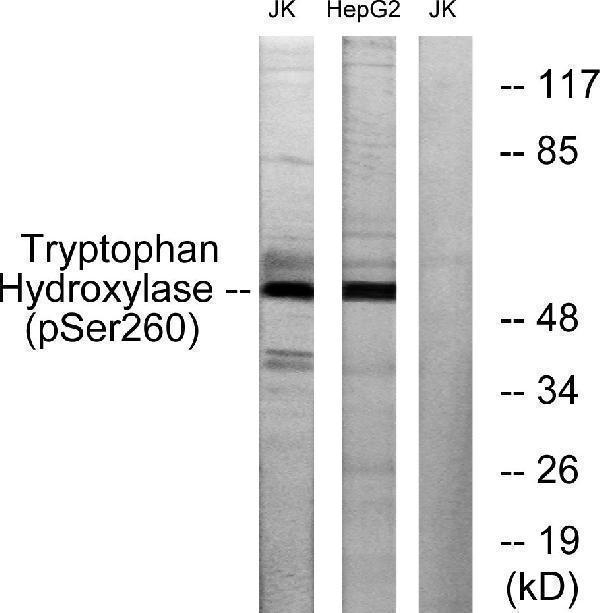 Western blot analysis of lysates from Jurkat cells and HepG2 cells, using Tryptophan Hydroxylase (Phospho-Ser260) Antibody