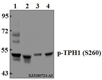 Western blot (WB) analysis of p-TPH1 (S260) pAb at 1:500 dilution
Lane1:HEK293T whole cell lysate(40µg)
Lane2:The Lung tissue lysate of Mouse(40µg)
Lane3:LO2 whole cell lysate(40µg)
Lane4:C6 whole cell lysate(40µg)