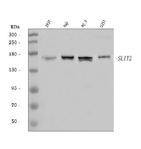  Western blot analysis of SLIT2 using anti-SLIT2 antibody (A01627-1)