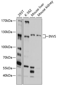 Western blot analysis of extracts of various cell lines, using INVS antibody  at 1:1000 dilution
