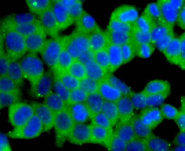 a01629 2 dnm2 primary antiboties icc testing 2