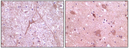 Immunohistochemistry analysis of paraffin-embedded human cerebrum tissue (left) and myelencephalon tissue (right), showing cytoplasmic localization with DAB staining using Dynamin II Monoclonal Antibody
