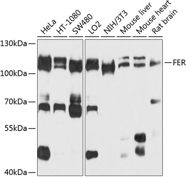 Western blot analysis of extracts of various cell lines, using FER antibody  at 1:1000 dilution