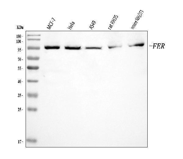  Western blot analysis of FER using anti-FER antibody (A01630-3)