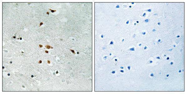 Immunohistochemistry analysis of paraffin-embedded human brain, using FER (Phospho-Tyr402) Antibody