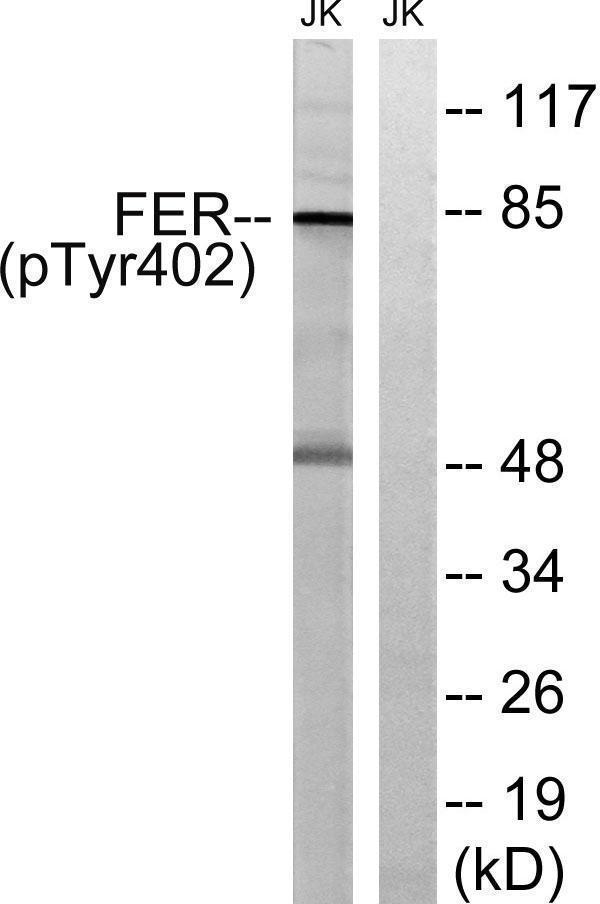 Western blot analysis of lysates from Jurkat cells treated with starved 24h, using FER (Phospho-Tyr402) Antibody