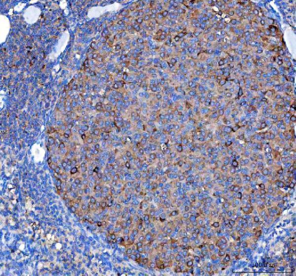  IHC analysis of MVD using anti-MVD antibody (A01631-2)