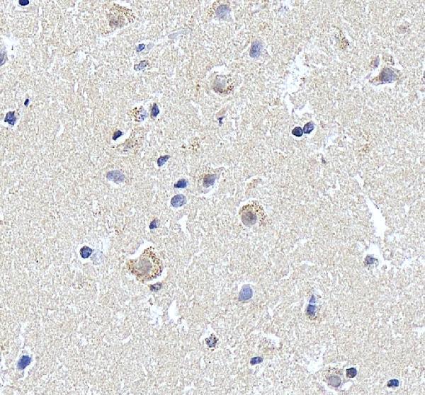 IHC analysis of MVD using anti-MVD antibody (A01631-2)