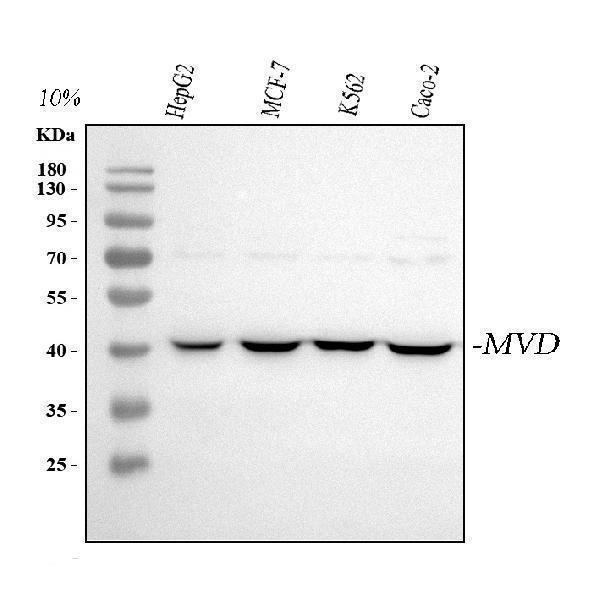  Western blot analysis of MVD using anti-MVD antibody (A01631-2)