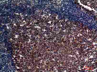 Immunohistochemistry (IHC) analysis of paraffin-embedded Human Tonsils, antibody was diluted at 1:100