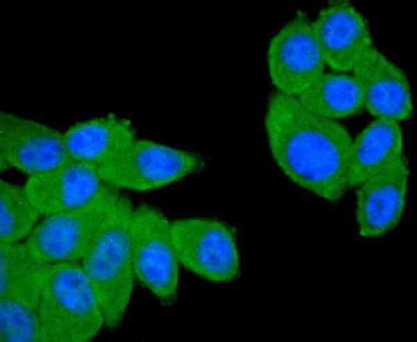 ICC staining CD21 in HepG2 cells (green)