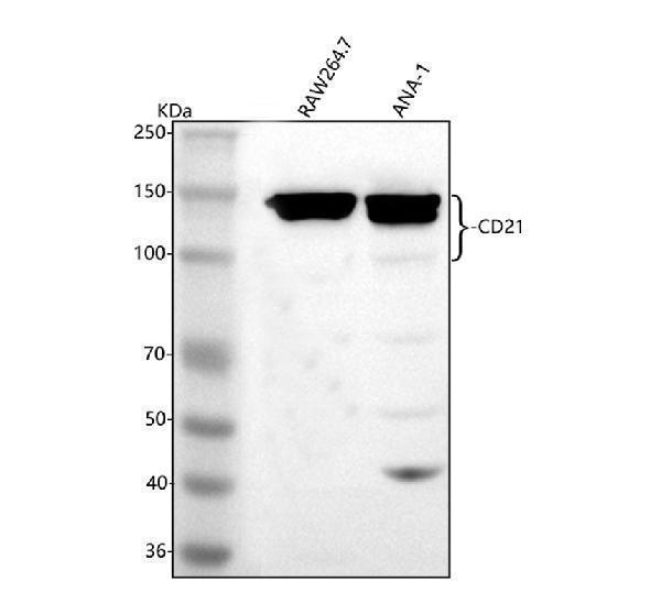  Western blot analysis of CD21/CR2 using anti-CD21/CR2 antibody (A01632-5)