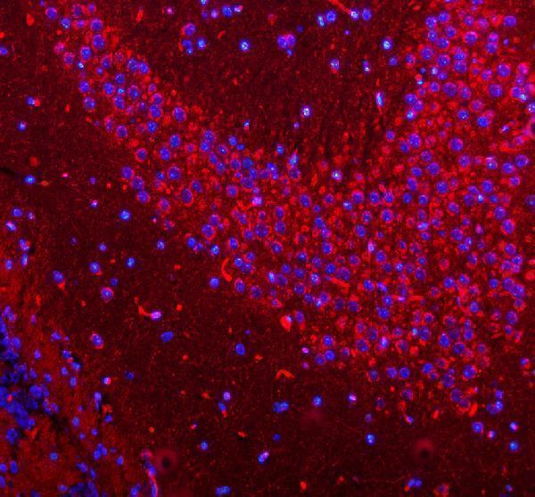 a01633 1 hcrt primary antibodies if testing 11