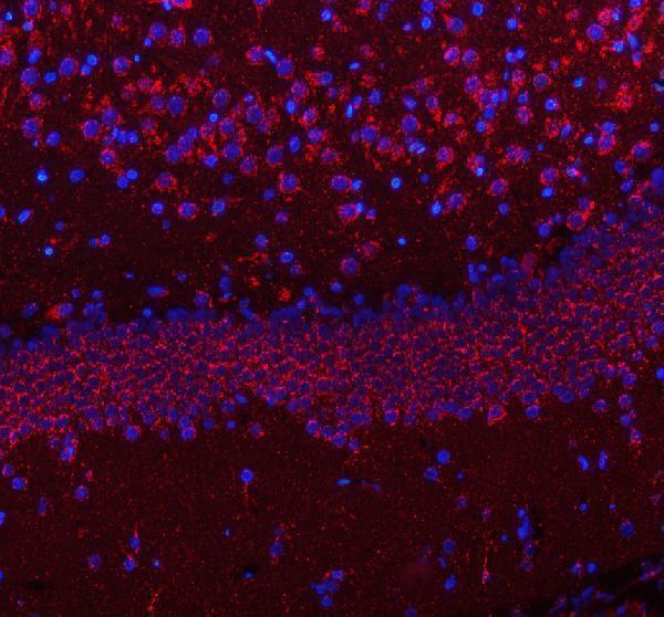 a01633 1 hcrt primary antibodies if testing 12
