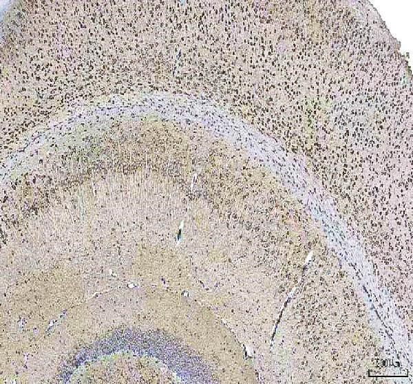  IHC analysis of HCRT using anti-HCRT antibody (A01633-1)