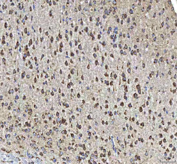  IHC analysis of HCRT using anti-HCRT antibody (A01633-1)