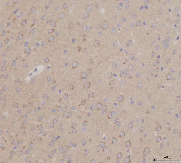 IHC analysis of GALC using anti-GALC antibody (A01634-1)