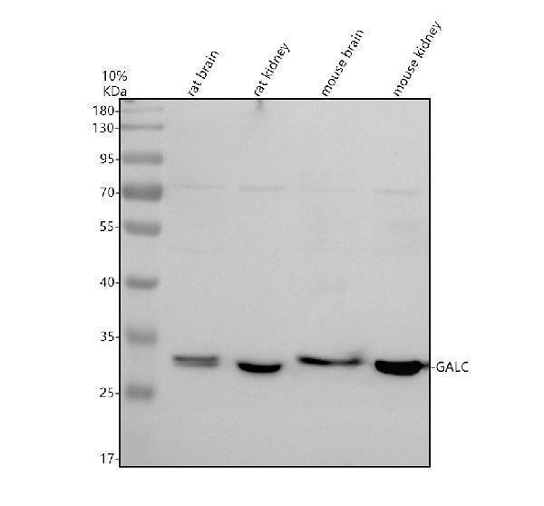 Western blot analysis of Galc using anti-Galc antibody (A01634-2)
