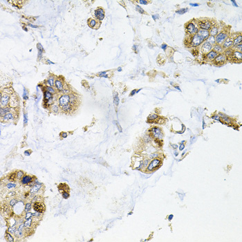 a01634 galc primary antiboties ihc testing 2