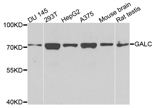 a01634 galc primary antiboties wb testing 1