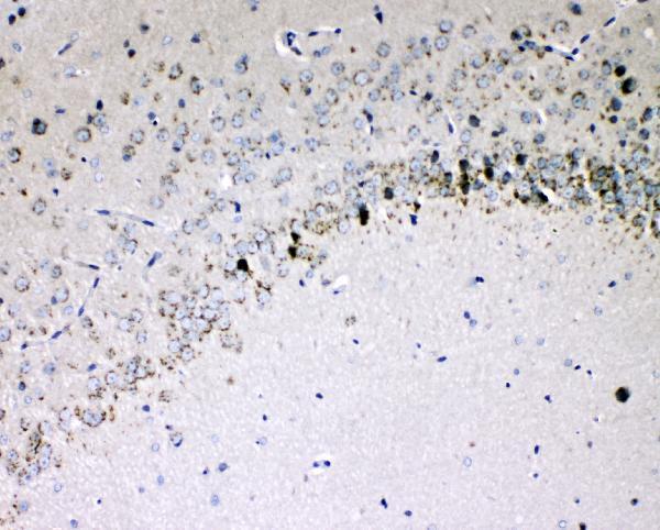 a01635 1 il 16 primary antibodies ihc testing 3