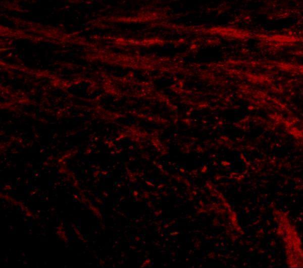 Immunofluorescence of IL-16 in mouse brain tissue with IL-16 antibody at 20 μg/mL