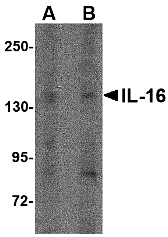 Western blot analysis of IL-16 in rat brain tissue lysate with IL-16 antibody at (A) 1 μg/ml and (B) 2 μg/mL
