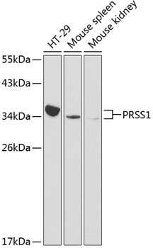 a01637 1 prss1 primary antiboties wb testing 1