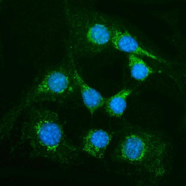 a01638 1 gpt primary antibodies if testing 4